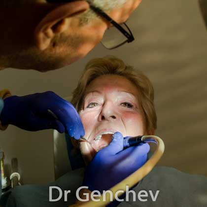 Dr Genchev pose un implant dentaire basal en Bulgarie
