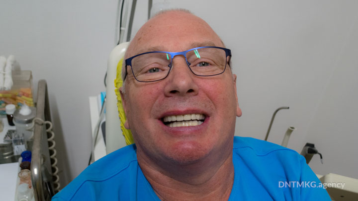 patient smiling after basal dental implant restoration